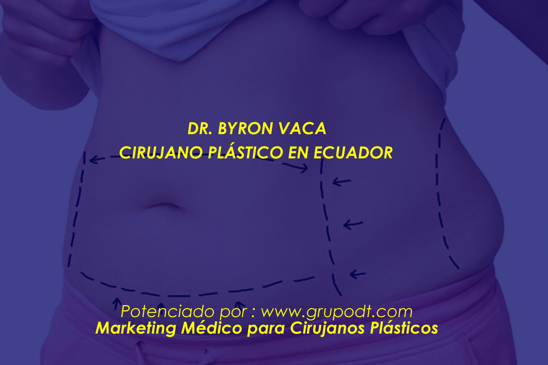 rinoplastia-quito